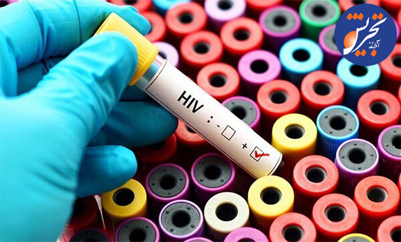 انجام تست HIV ریگان و محرمانه در سراسر کشور